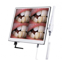 RA300 Cámara Intraoral