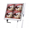 RA300 Cámara Intraoral